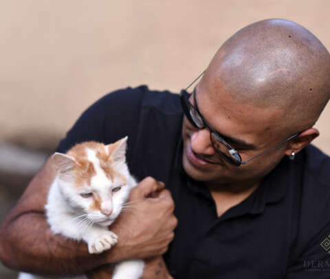 Scalp micropigmentation Pune India Follicraft Dermakraft