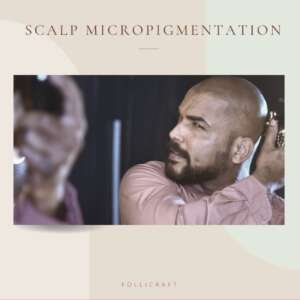 Scalp micropigmentation India Dermakraft