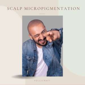 Scalp micropigmentation India Dermakraft