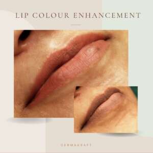Lip Permanent makeup Dermakraft India