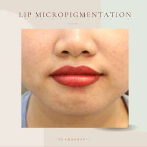 Lip Permanent makeup Dermakraft India